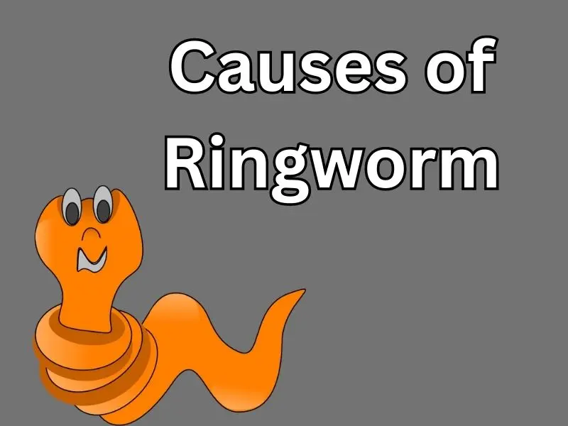 Causes of Ringworm